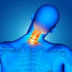 How to Get Rid of a Stiff Neck_resultat